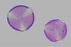 Grain de pollen d'érable (<em>Acer sp.</em>). On distingue bien les 3 trois apertures (ou <em>colpus</em>) qui sont un caractère dérivé caractéristique du clade des Dicotylédones vraies (ou Eudicotylédones).  [23781 views]