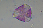 Grain de pollen de Prunus. On distingue bien les 3 trois apertures (ou colpus) qui sont un caractère dérivé caractéristique du clade des Dicotylédones vraies (ou Eudicotylédones).  [22864 views]