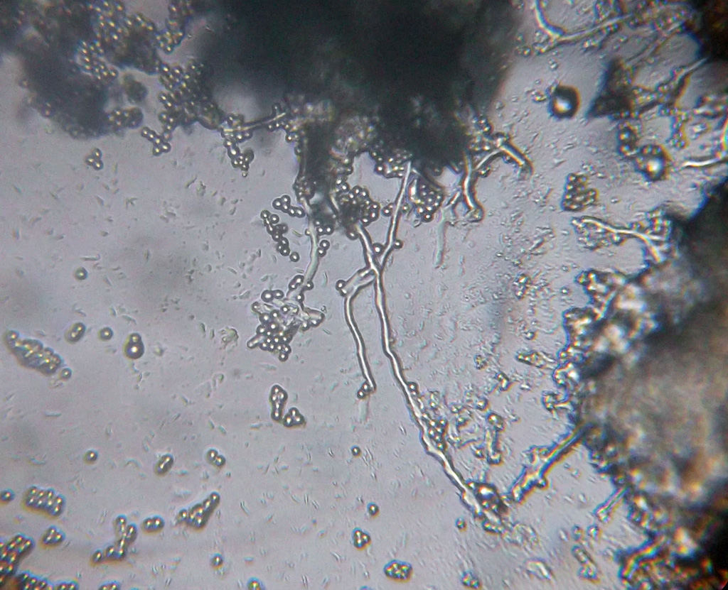 Spores et filaments de <em>Penicillum roqueforti</em> pris sur du Roquefort, vus au microscope grossissement x400. Montage réalisé par une élève de 3<sup>ème</sup> entre lame et lamelles avec goutte d'eau, sans colorant. 