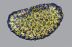 Spore de Polypode. L'image est une pile de 7 photos. [22953 views]