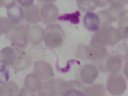 La maladie de Chagas (agent : <em>Trypanosoma cruzi</em>, phylum des Protozoaires). [17671 views]