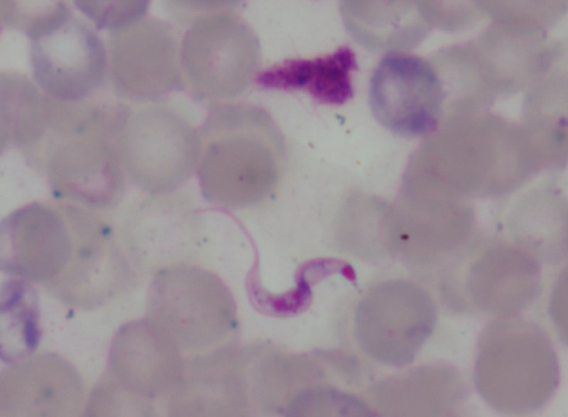 La maladie de Chagas (agent : <em>Trypanosoma cruzi</em>, phylum des Protozoaires).
